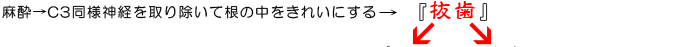 『抜歯』